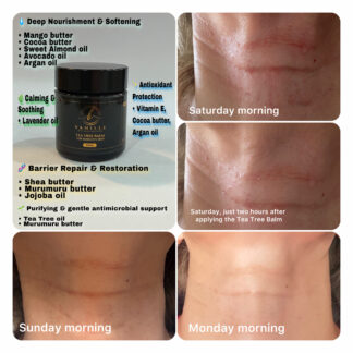 Tea Tree Balm for Sensitive Skin (Palm oil free) 30 ml